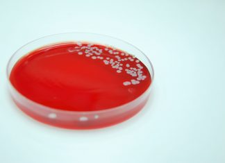 Bacterial Culture of Staphylococcus aureus