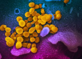 A scanning electron microscope image shows SARS-CoV-2 (yellow) – also known as 2019-nCoV, the virus that causes COVID-19 –isolated from a patient in the US, emerging from the surface of cells (blue/pink) cultured in a lab. Image: NIAID-RML